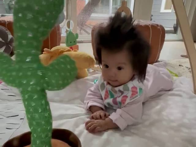 Millie Ray, a five-month-old baby with abnormally thick hair, Vancouver, British Columbia, Canada, 2023. See SWNS story SWSMhair. This baby has such an impressive head of hair that people think she's wearing a wig. Millie Ray, a five-month-old, was born with thick hair, and it has now grown so thick that people assume she's wearing a wig for babies. Julia Zhou, AGE, and Alex Kwong, AGE, Millie's parents say that people are fascinated by the tot's impressive mop of hair. They often ask the young parents, from Vancouver, B.C., Canada, if she is wearing a wig and assume she's older than she is. 