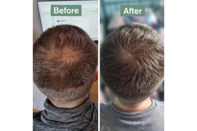 Dr Vegan Hair Saviour - James' results
