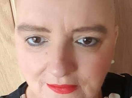 Emma Jayne Ainscough - I completed chemo and major surgery in the middle of a pandemic, but I'm still here and cancer free at the moment.