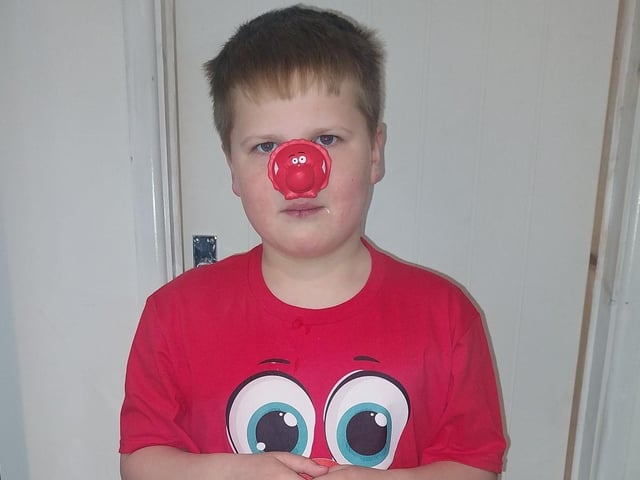 Billy-John is seven years old and dressed up for Red Nose Day.