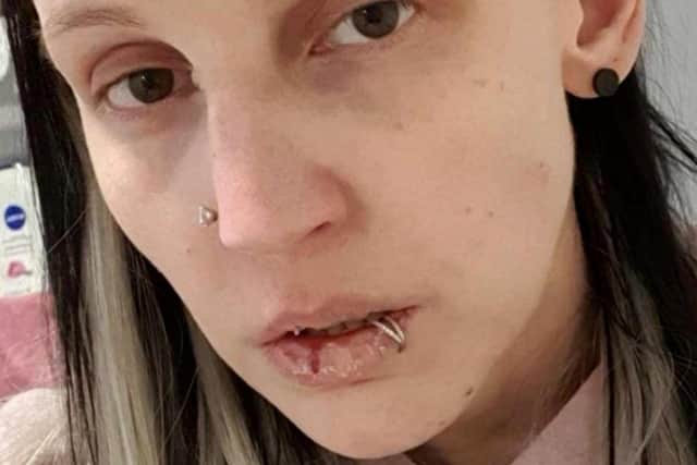 Amylee Pincott, 33, after suffering with ill health due to mould.