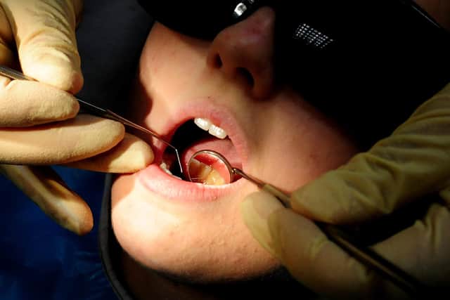 There were almost a dozen hospital admissions in Mansfield to remove children's decaying teeth last year