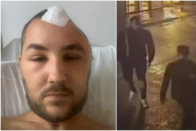 Perry Cranston sustained serious head injuries in the attack and had to have a portion of his skull removed after being put into an induced coma.