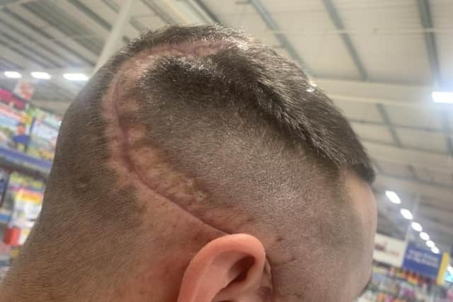Perry says he can 'no longer have a normal life' after the horrific attack.