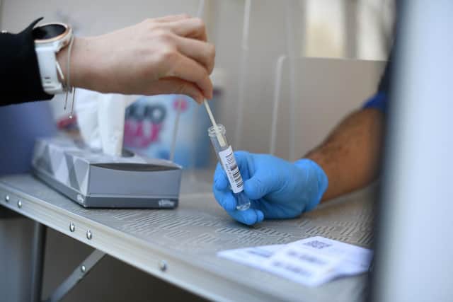The number of recorded coronavirus cases in Nottinghamshire increased by 100 over the weekend, official figures show. (Photo by DANIEL LEAL-OLIVAS/AFP via Getty Images)