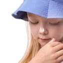 NHS chiefs have issued advice for people to stay safe during the heatwave. Photo: Submitted