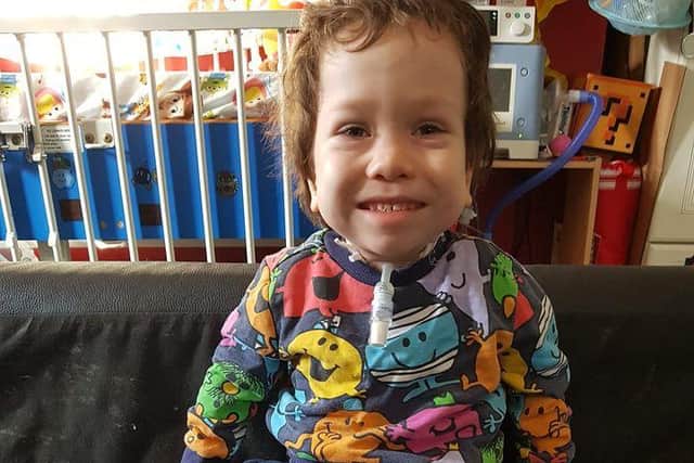 Tommy, four, has breathing difficulties due to small airways and a form of dwarfism