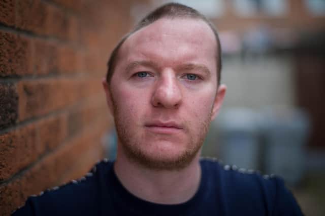Branden Stromberg lost half his skull after a vicious assault by Kyle Stephenson in Bolsover.