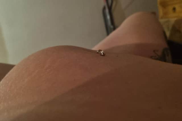 Steph's tumour has already grown considerably since her diagnosis two months ago.
