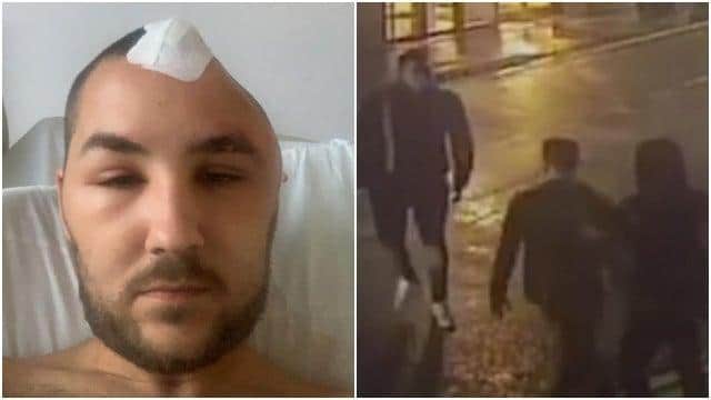 Perry Cranston was left with life-changing injuries following the attack.