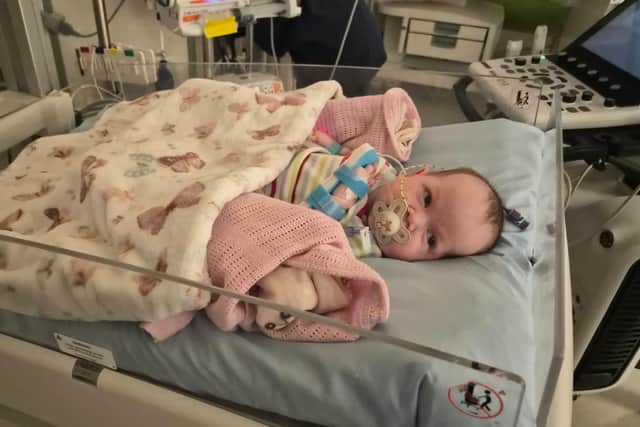 Baby Eden underwent a live saving heart operation after medics discovered she had a serious heart condition