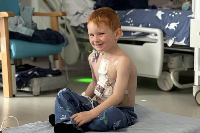 Brave little Mason underwent two major heart operations within the space of just one week.