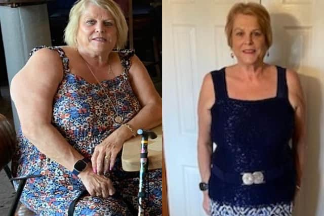 Bev Lynam before and after her incredible weight loss.