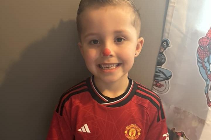 A Manchester United shirt to match the nose... Nice!