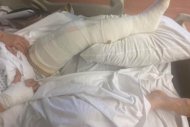 Tara suffered a broken right arm and shoulder, a fractured left knee as well as a double break to her left leg