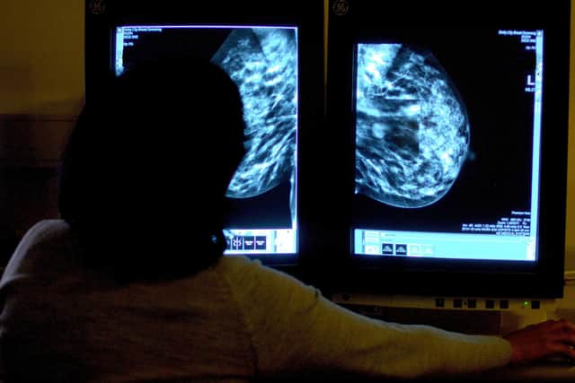 Across England, there were roughly 40,400 fewer cancers diagnosed in 2020,