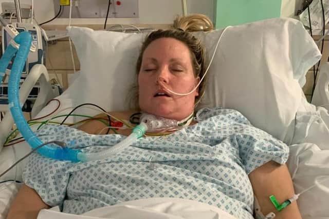 Kerri was in a coma for 31 days.