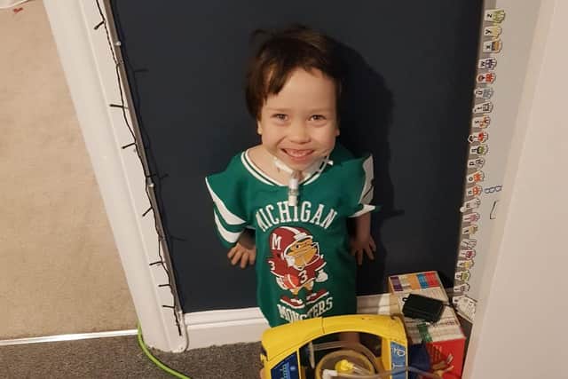 Tommy has breathing difficulties due to small airways and a form of dwarfism