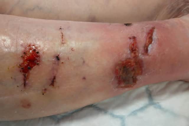 Brenda suffered nasty cuts and wounds to her leg after the cat attacked her. Photo: Submitted