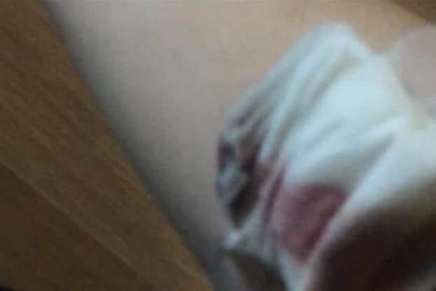 Lizzy ended up on a drip in hospital and is still feeling the after-effects two days later