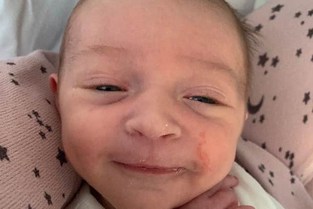 Francis James with a smile on his face following his first feed after surgery.