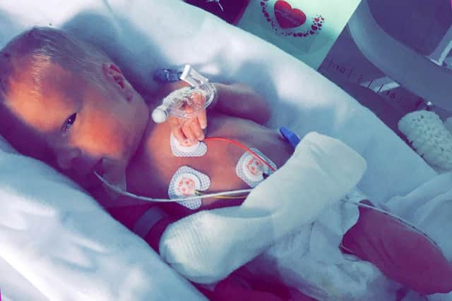 Little Cobie was born 10 weeks early