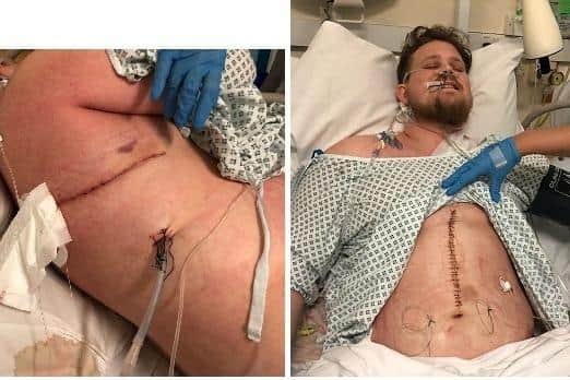 Nathan has undergone operations as well as radiotherapy and chemotherapy
