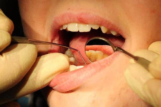 The impact of the coronavirus pandemic on dental care has been laid bare by new figures revealing a slump in treatments delivered to Nottinghamshire patients.