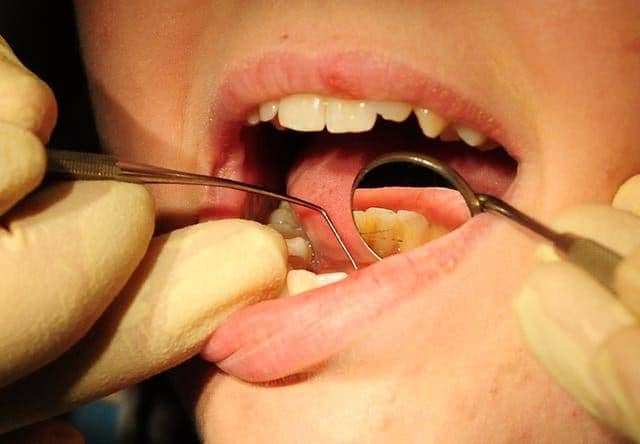 The impact of the coronavirus pandemic on dental care has been laid bare by new figures revealing a slump in treatments delivered to Nottinghamshire patients.