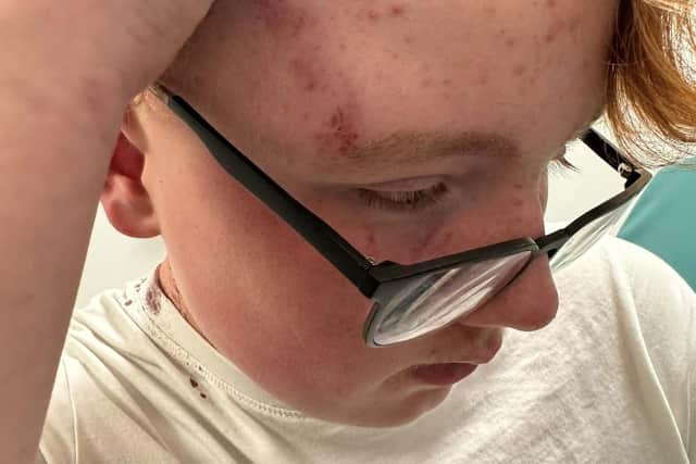 Zoey shared images of Kayden's injuries on the public fundraising page.