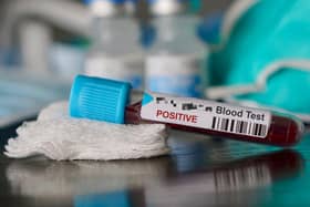There is a shortage of bottles for blood tests.