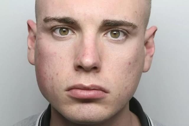 Sutton man left with fractured skull and bleed on brain after unprovoked ...