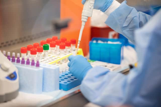 The first case of coronavirus in Sheffield was confirmed by Public Health England on March 11 (pic: Andrew Theodorakis/Getty Images