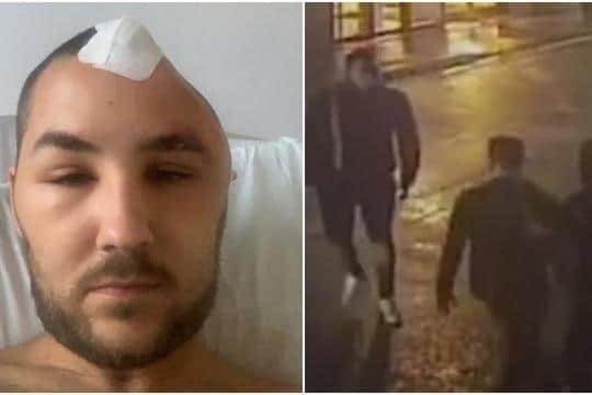 Perry shortly after the assault, alongside CCTV footage which was shown in court.