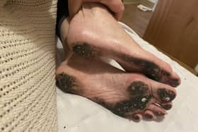 Paula's mother's feet pictured covered in dirt in her bed. Credit: Paula Yarnall