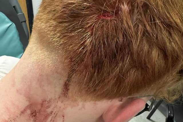 An additional image of Kayden's injuries.
