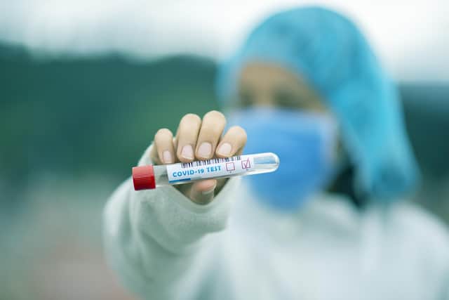 Almost 500 hospital patients were discharged to Nottinghamshire care homes before being tested for Covid-19