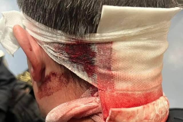 Dog handler PC Chris Duffy was left with a seven-inch wound across the back of his head exposing his skull when he was attacked from behind with a weapon.