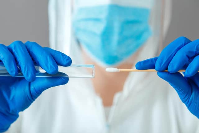 A total of 18,330 people had been confirmed as testing positive for Covid-19 in Ashfield when the UK coronavirus daily dashboard was updated on October 13.