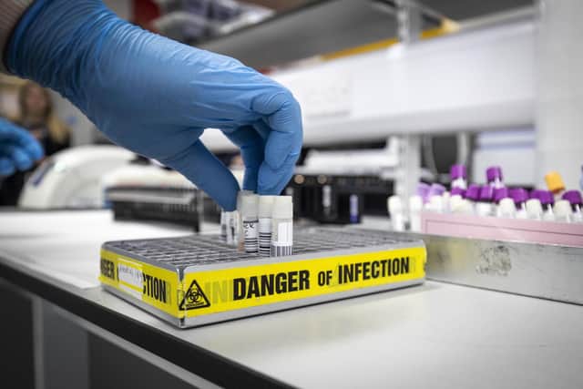 Here's what to do if you think you have coronavirus. (Photo: Getty).