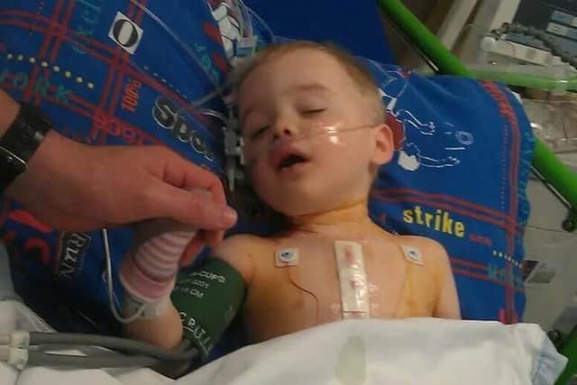 Brave Charlie Whitehouse underwent open-heart surgery when he was just three