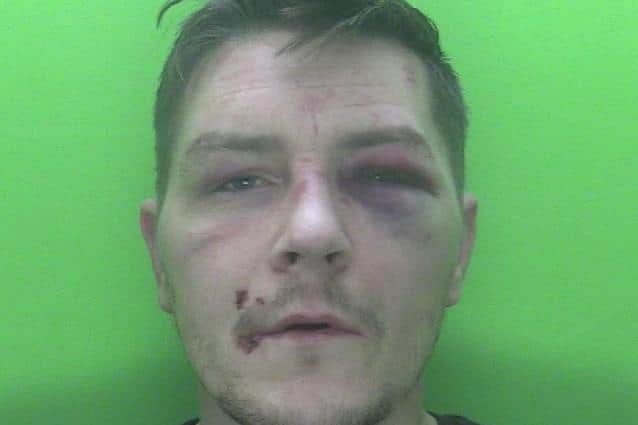 Adam Elliott pictured with injuries sustained prior to this incident.