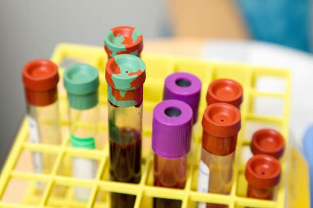 Nottinghamshire’s first Community Diagnostic Centre to (CDC) to Mansfield has celebrated delivering over 50,000 health checks and tests to local people