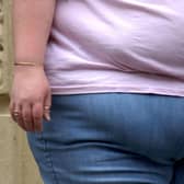 File photo dated 24/09/18 of an obese woman. A lack of consistency in reporting on obesity across the UK has created a postcode lottery for patient care, according to a new study.