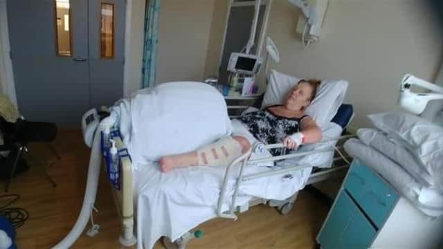 Debra has undergone a lot of treatment to help her recover from the accident.