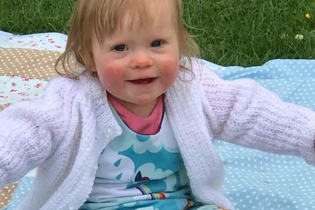 Jossie May Stone, 3, was born with Down's Syndrom