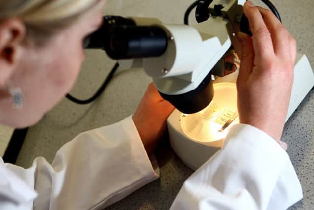 More 40,000 women missed their last cervical smear test. Photo: PA/David Davies