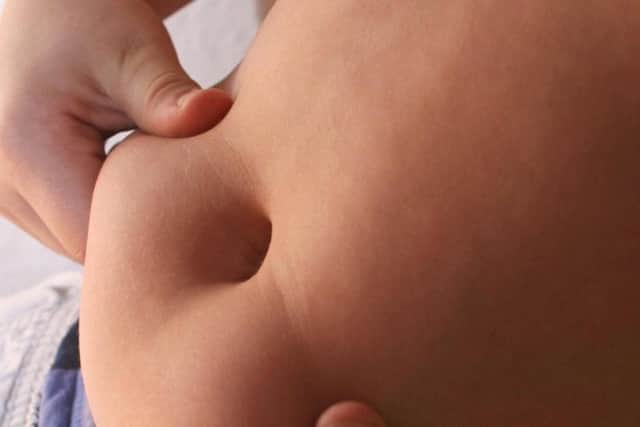 Nottinghamshire County Council pilot scheme to tackle childhood obesity