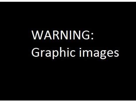 WARNING: Graphic images