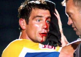 Wycombe Wanderers v Mansfield Town

A bloodied Mansfield Town's Richie Barker

Picture by Dan Westwell
